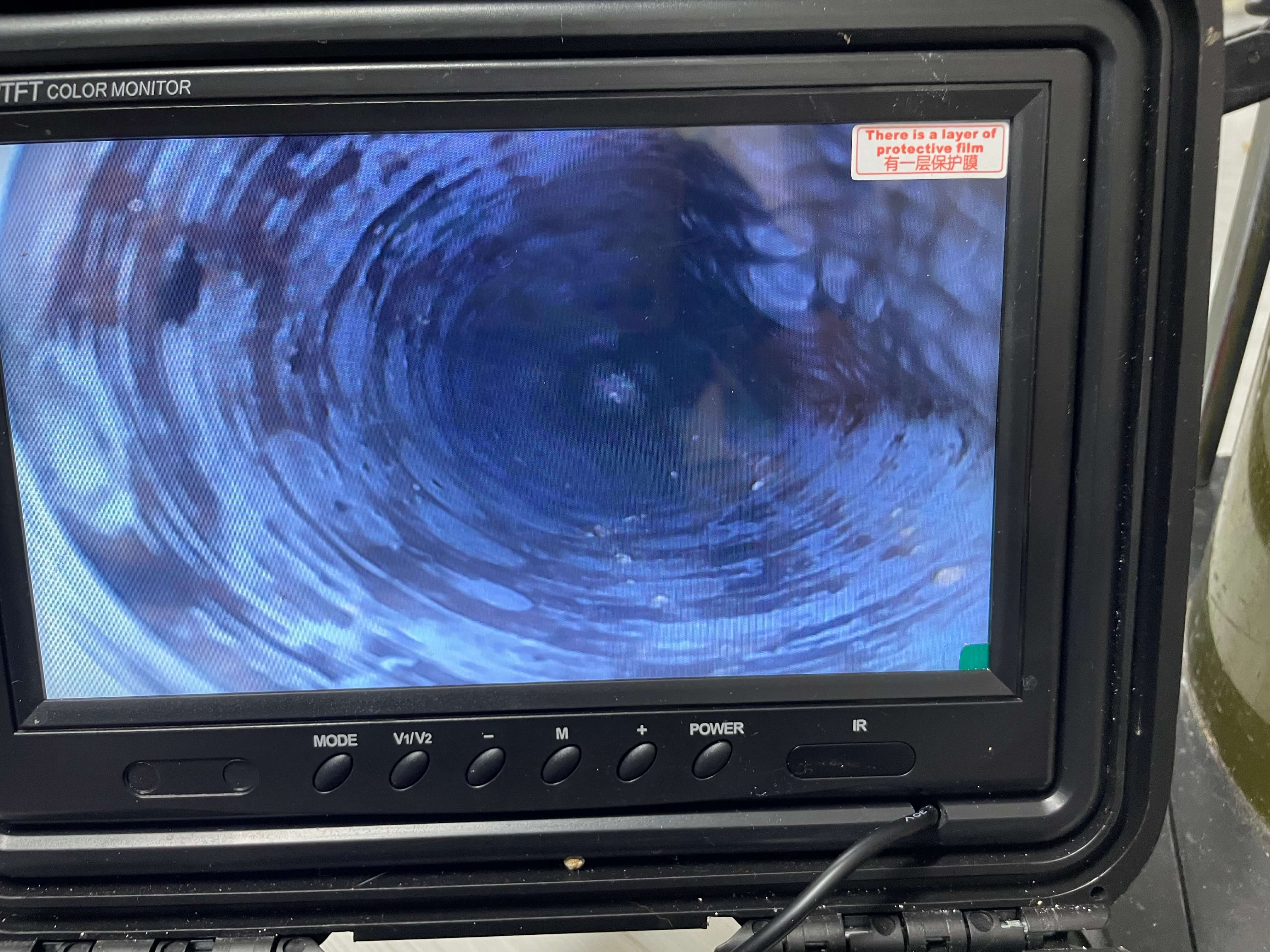 내시경 작업 진행 모습