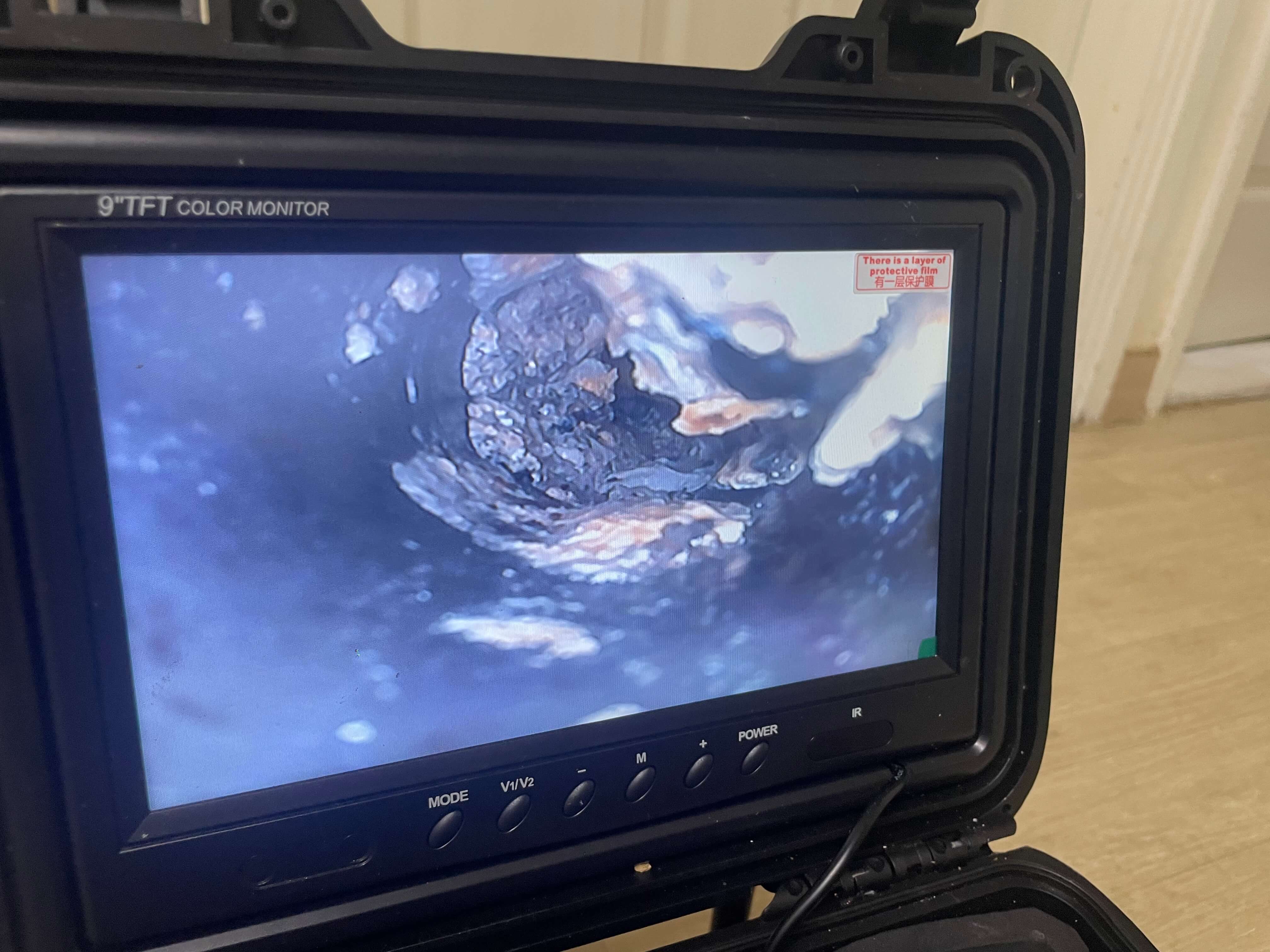 내시경 작업 사례